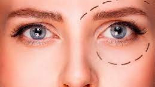 phytotherapy-for-sagging-eyelids-you’ll-see-outcomes-in-two-minutes