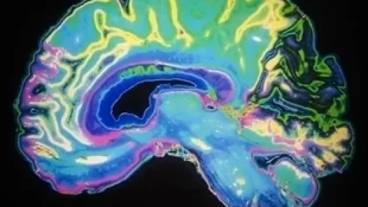 brain-scanning-technology-is-now-ready-for-use-in-clinical-psychedelic-experiments-thanks-to-a-new-“all-london-partnership.”